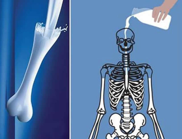 Kemik Erimesi Günü