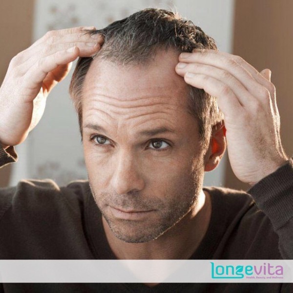 Saç ekimi - Longevita