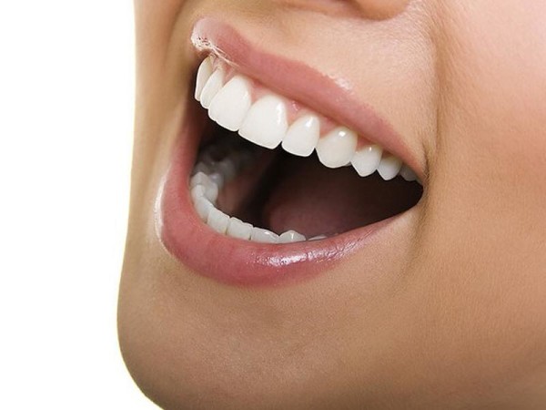 Lingual Ortodonti Tedavisi 