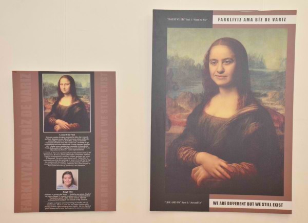 AİLELER ARTIK ENGELLİ ÇOCUKLARINI GİZLEMİYOR